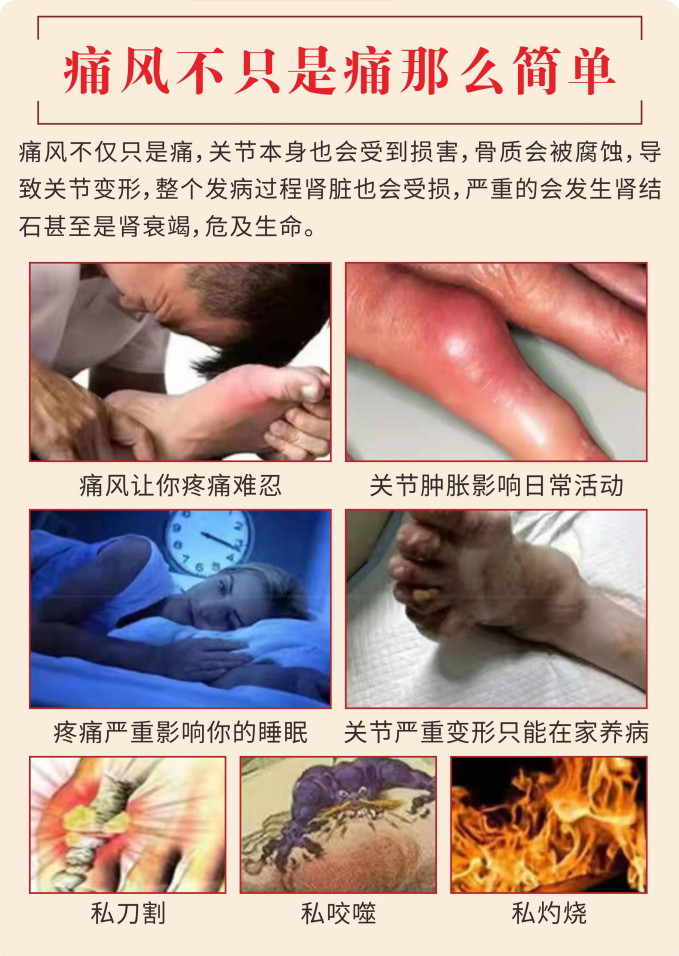 走進厚濟堂制藥有限公司痛風膏oem代加工全產業鏈一站式代工工廠