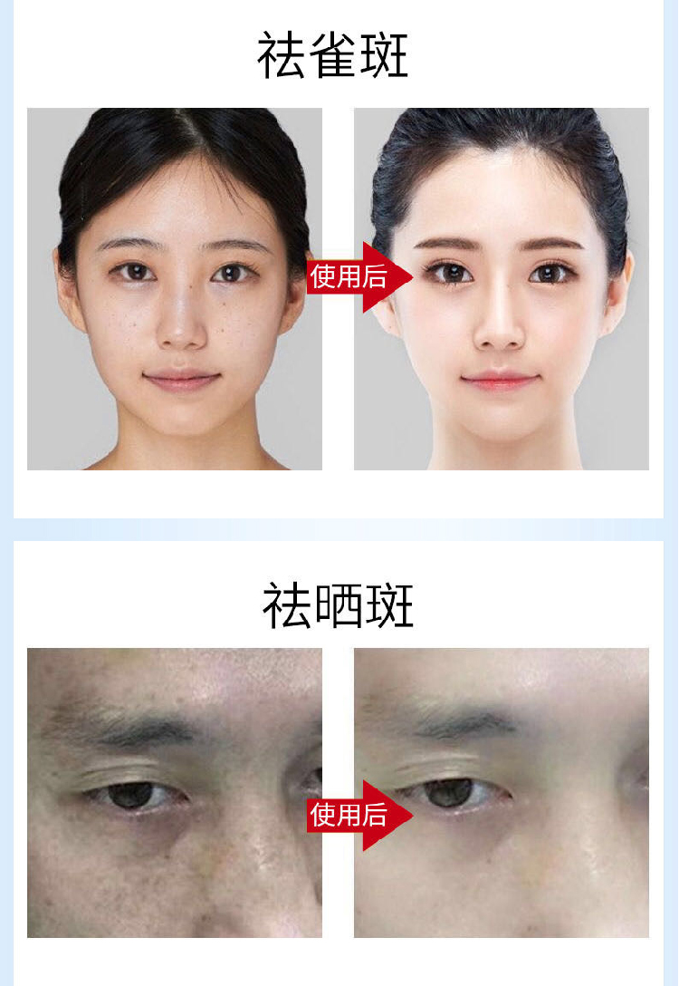 祛斑霜_07.jpg