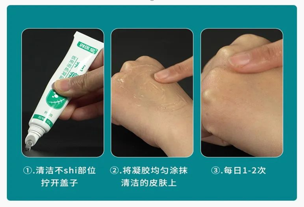 劉醫堂疤痕醫用退熱凝膠3.png
