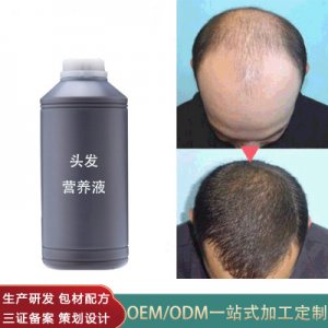 何首烏頭皮營養液代加工貼牌OEM/ODM