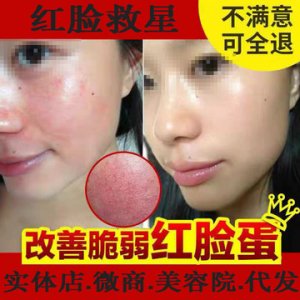 潤(rùn)膚修護(hù)面霜OEM貼牌OEM/ODM