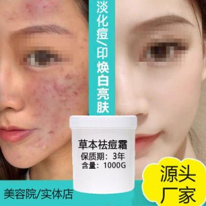 草本祛痘霜代加工貼牌OEM/ODM