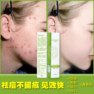 寶姿萊草本祛痘霜OEM代加工