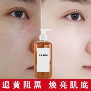 熊果苷提亮膚色嫩膚面部護(hù)理祛黃淡斑雀斑精華液OEM/ODM代加工