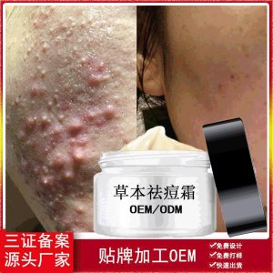 控油祛痘膏貼牌定制代加工