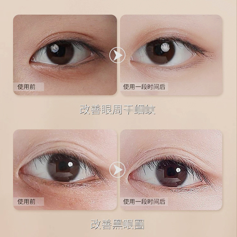 緩解眼疲勞眼酸家用冷敷護眼貼OEM代加工