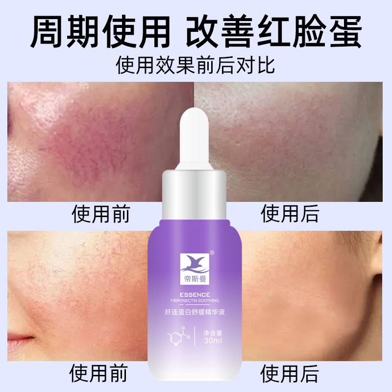 去除紅血絲增厚角質層改善敏感肌膚修復臉部泛紅高原紅化妝品批發OEM代加工